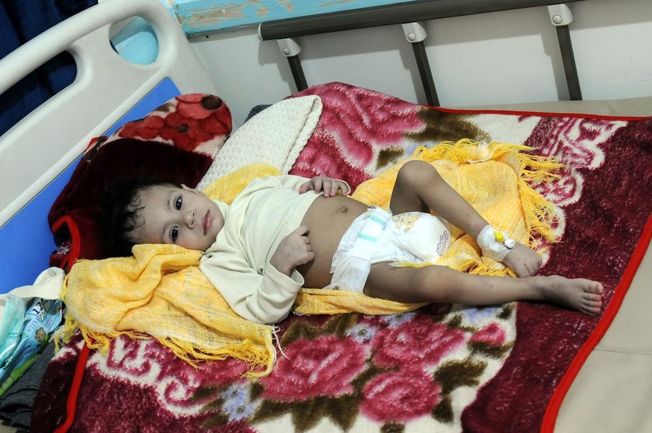 Le Yémen menacé par une nouvelle "vague majeure" de cas de choléra